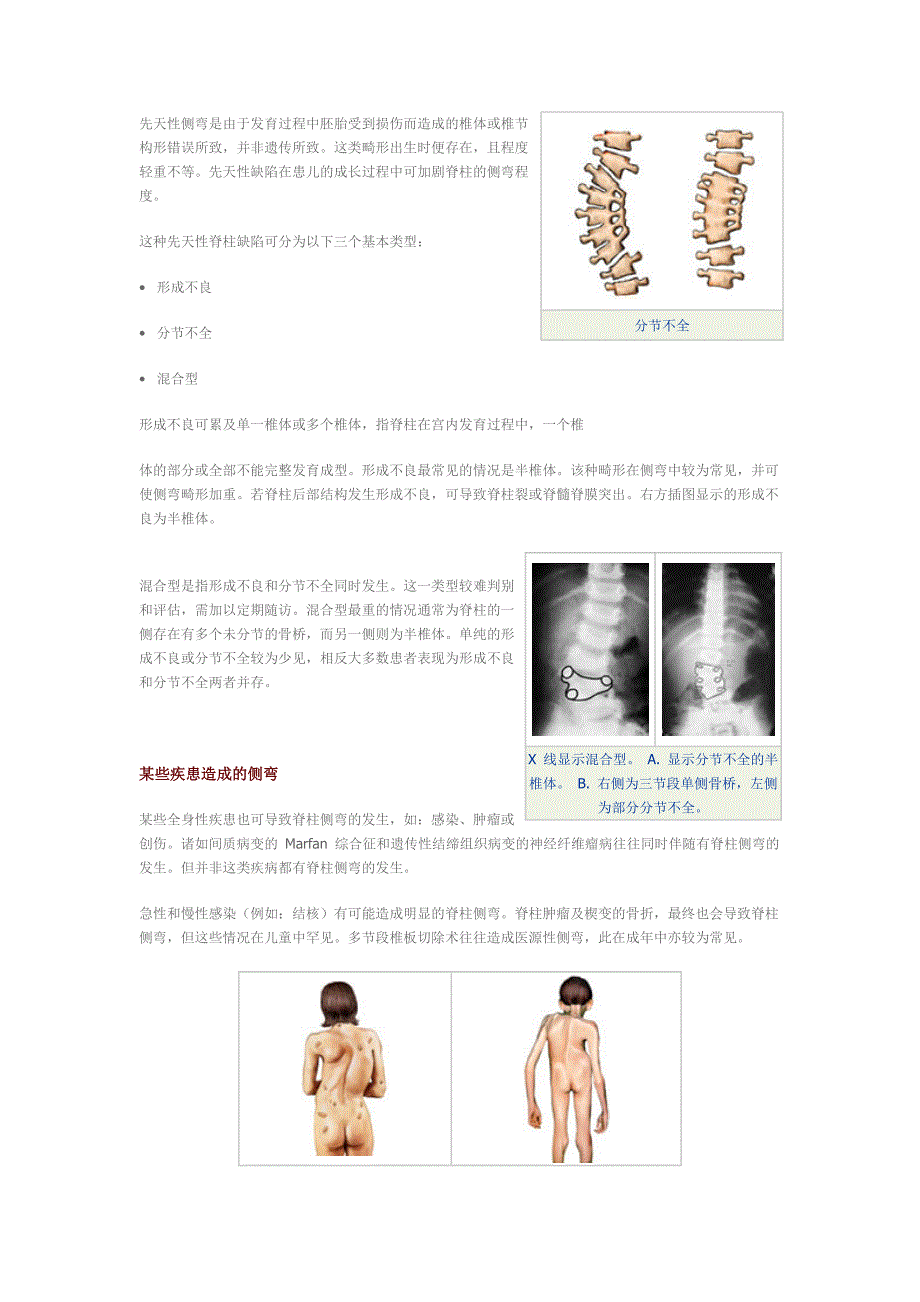 脊柱生物力学基本知识_第3页