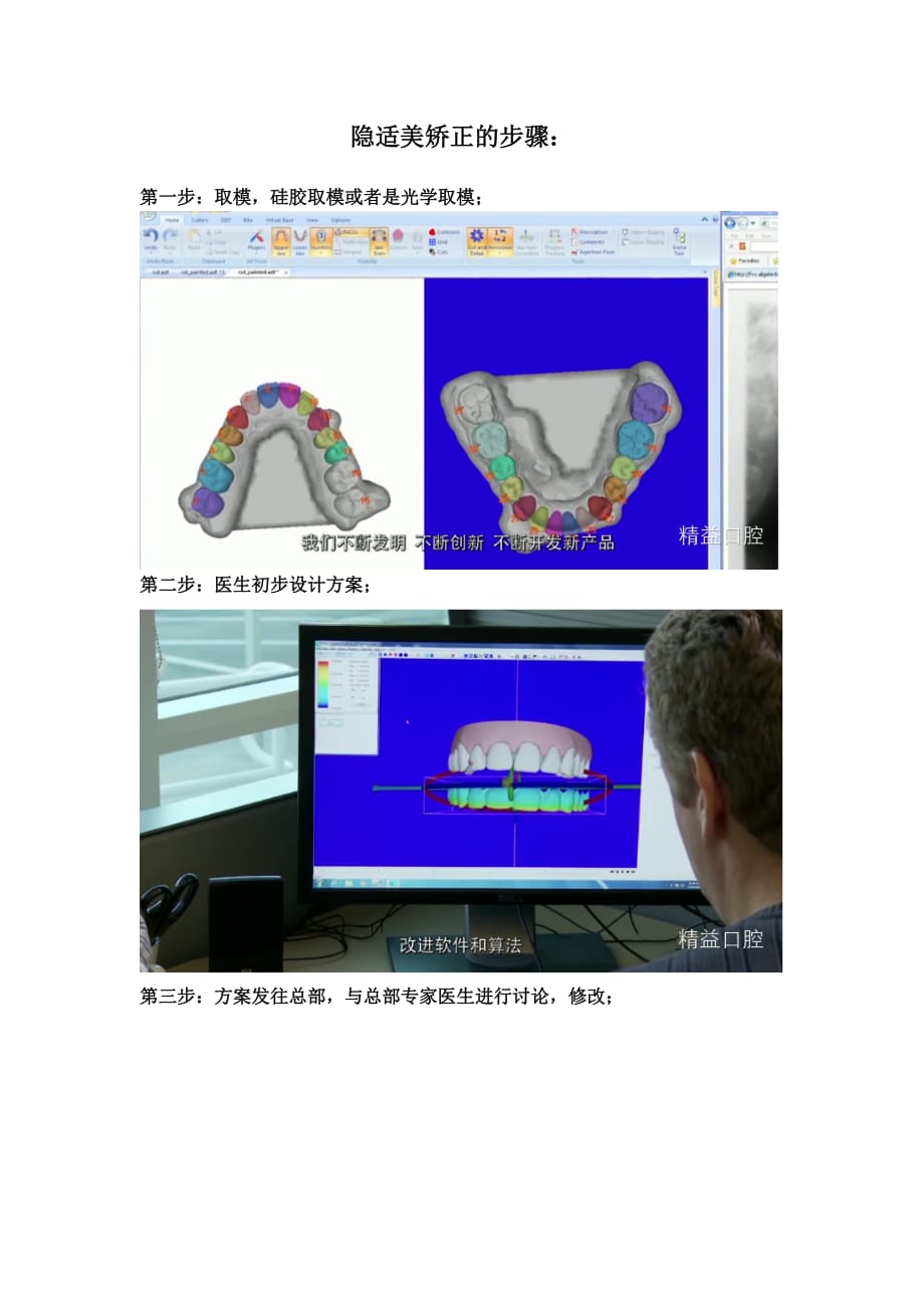 隐适美矫正的步骤_第1页