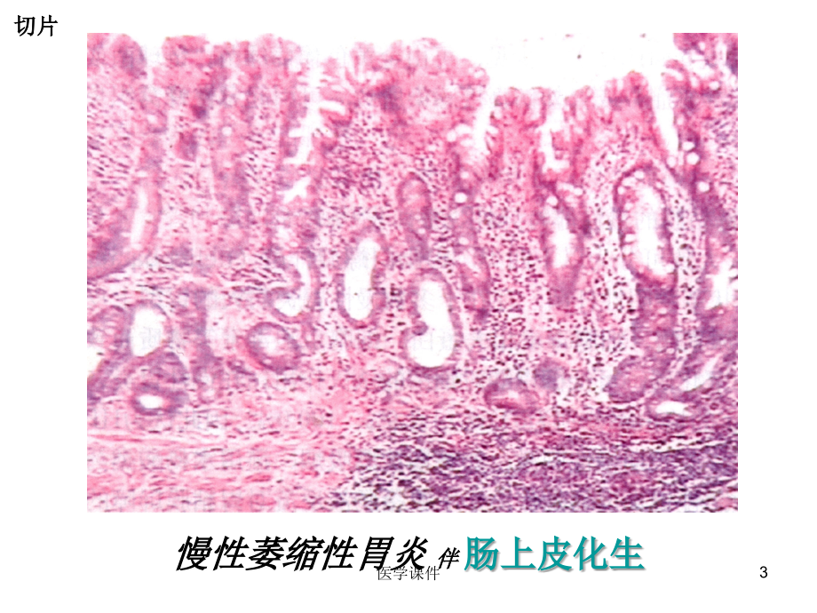 组织胚胎学--切片-课件_第3页