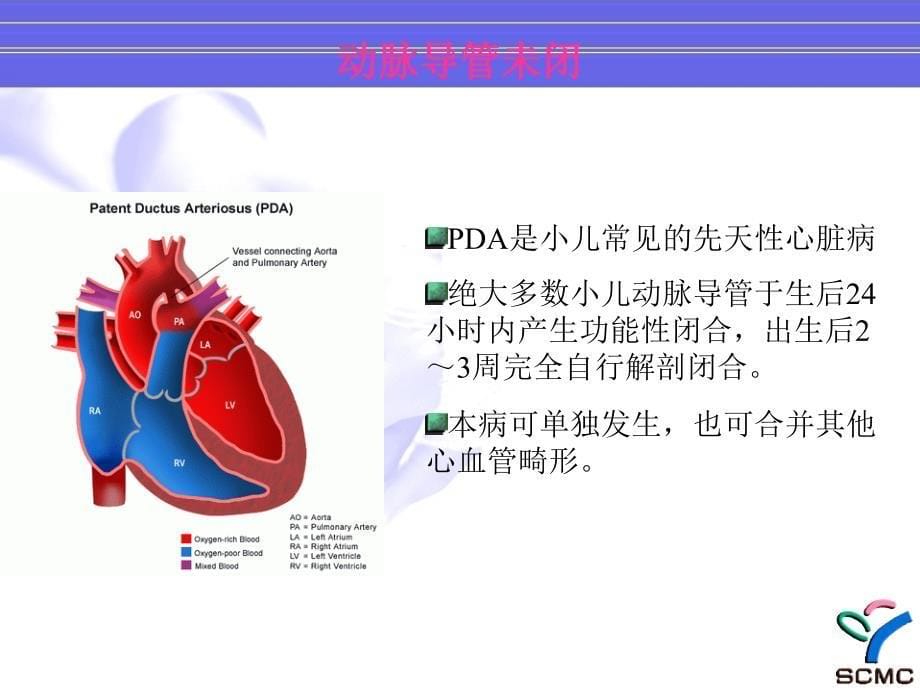 先心病手术时机和手术方法资料_第5页