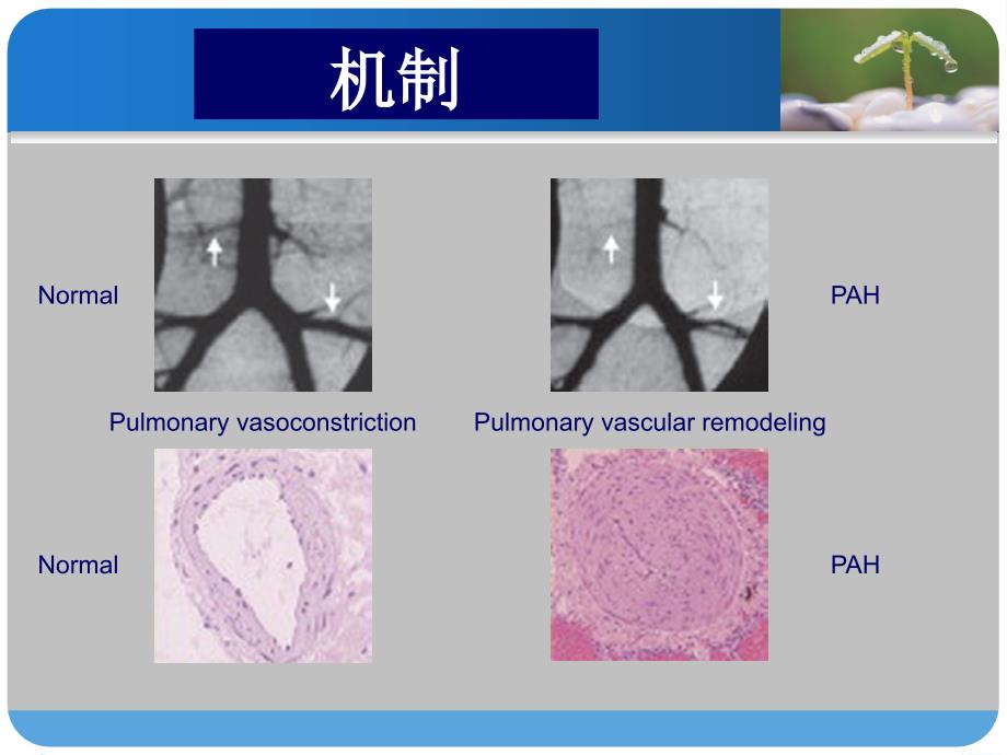 诊断标准_第4页