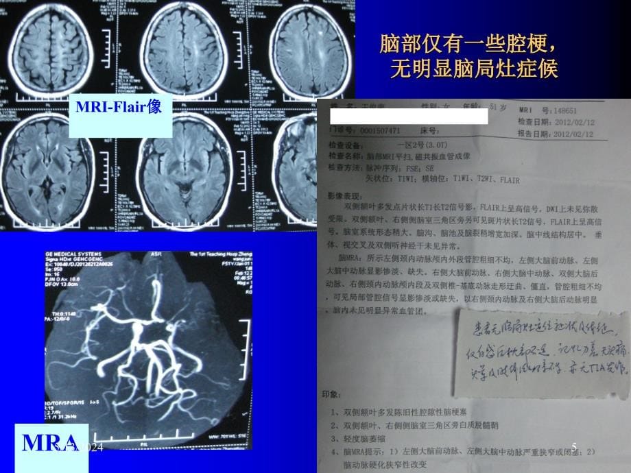 缺血性卒中分型xiou_第5页