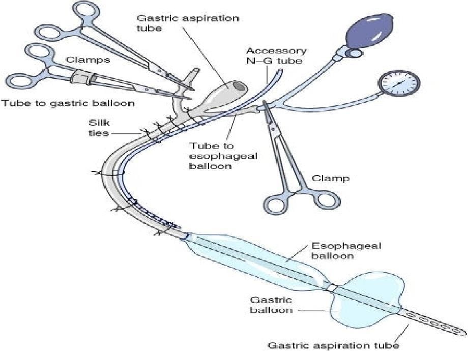 三腔两囊管护理剖析_第5页