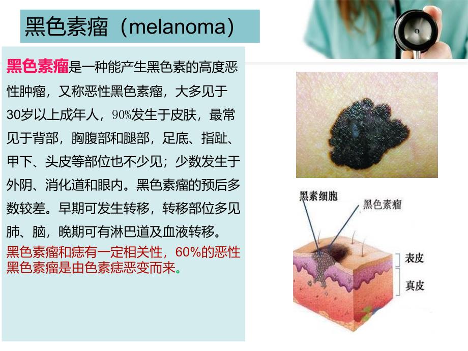 恶性黑色素瘤患者护理分析_第3页