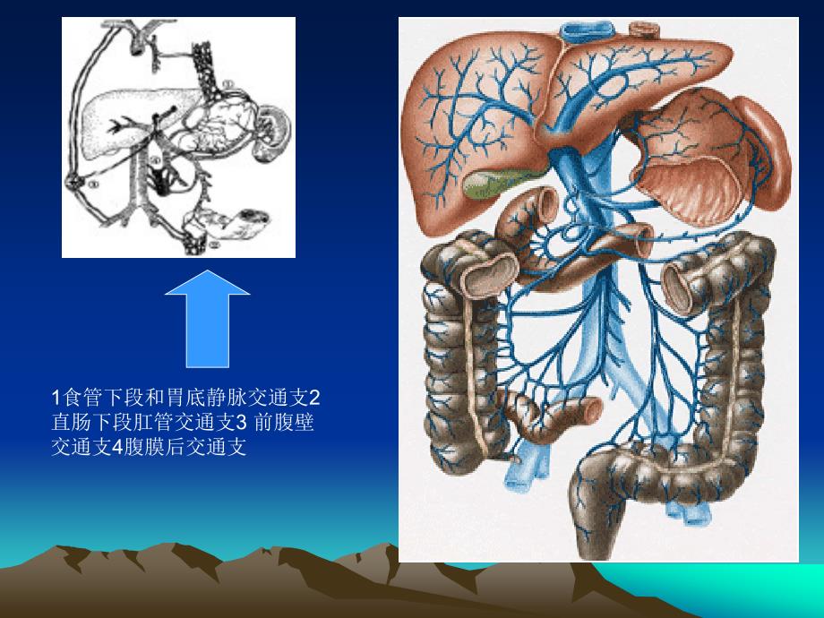 肝硬化并消化道出血讲解_第4页