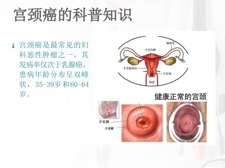 宫颈癌广泛性子宫切除+盆腔淋巴结清扫手术配合资料_第2页