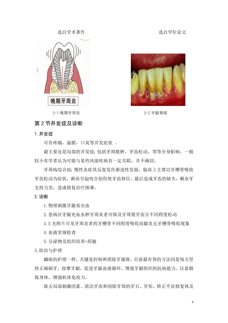 专业口腔毕业论文.doc_第4页