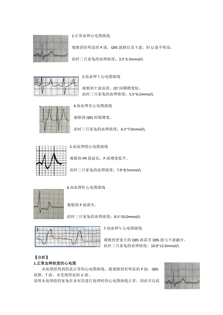 不同浓度的钾离子对心电图的影响.doc_第4页