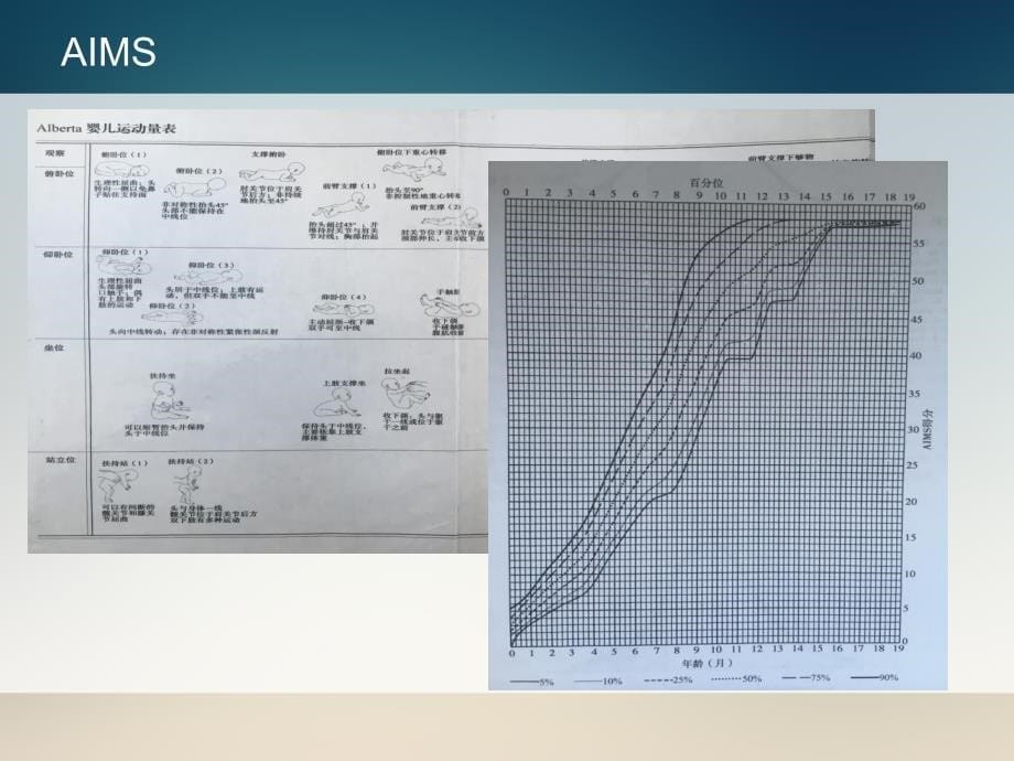 儿童发育量表的应用与分析资料_第5页