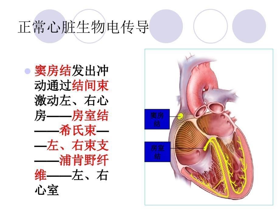 床边临时起搏及护理_第5页