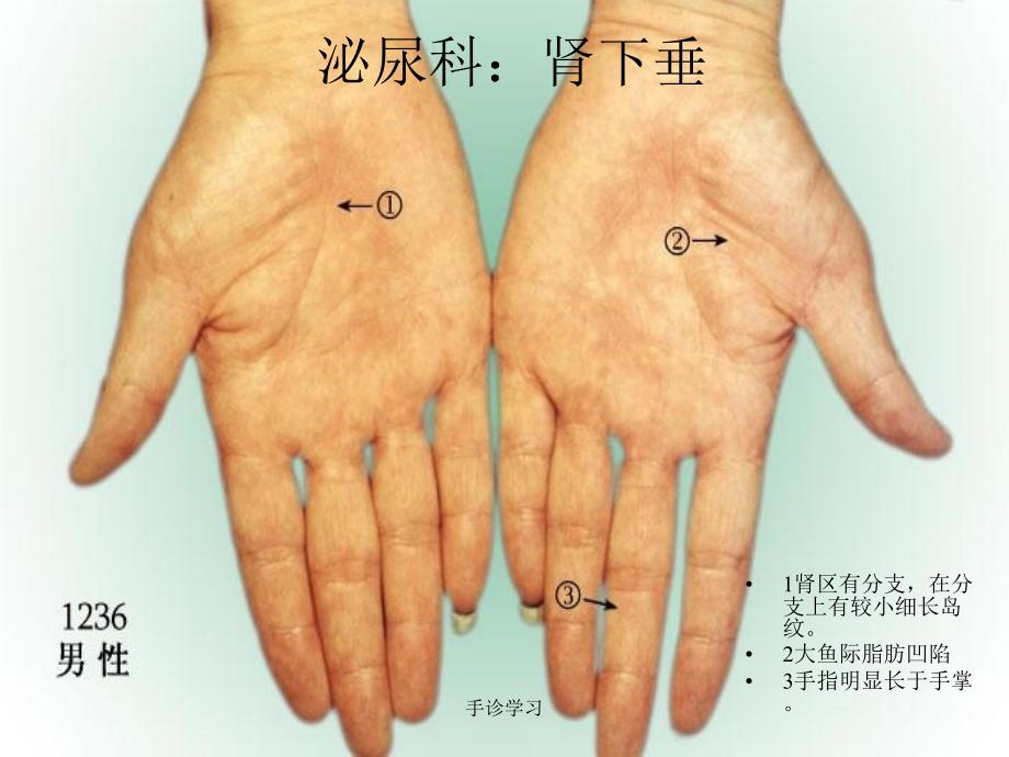 手诊学习课件_第4页