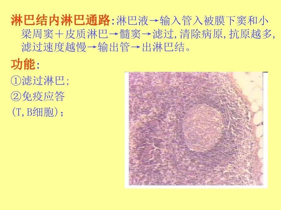 肿瘤-淋巴造血系统疾病.ppt_第5页