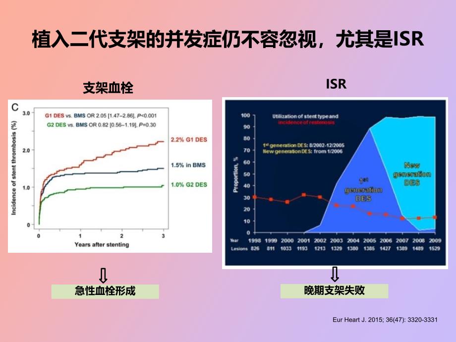 药物涂层球囊局部药物输送系统科室_第3页