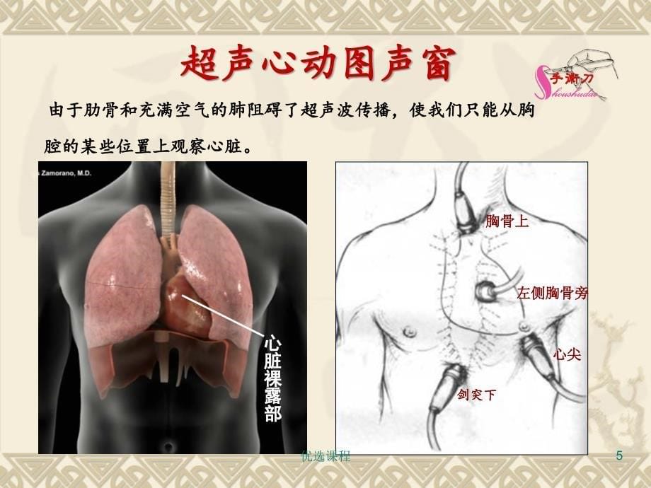 心脏超声常规切面与手法操作特制荟萃_第5页