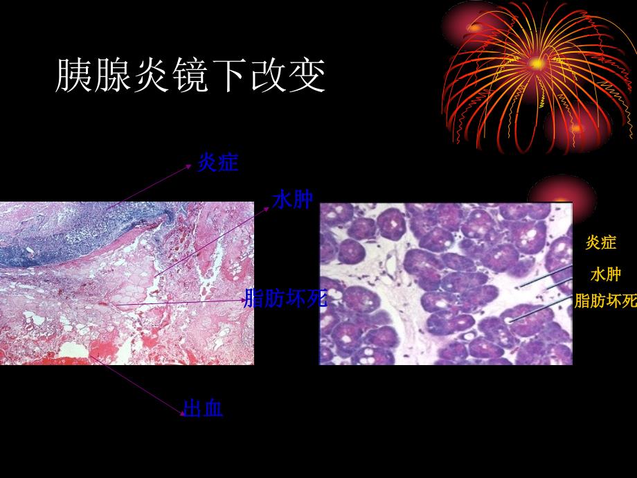 胰腺炎怎么治_第4页