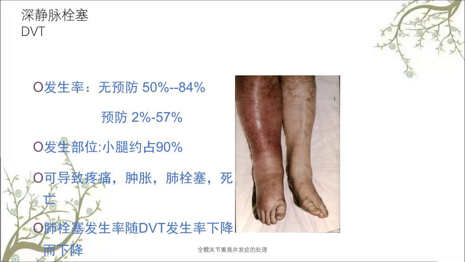 全髋关节置换并发症的处理_第4页