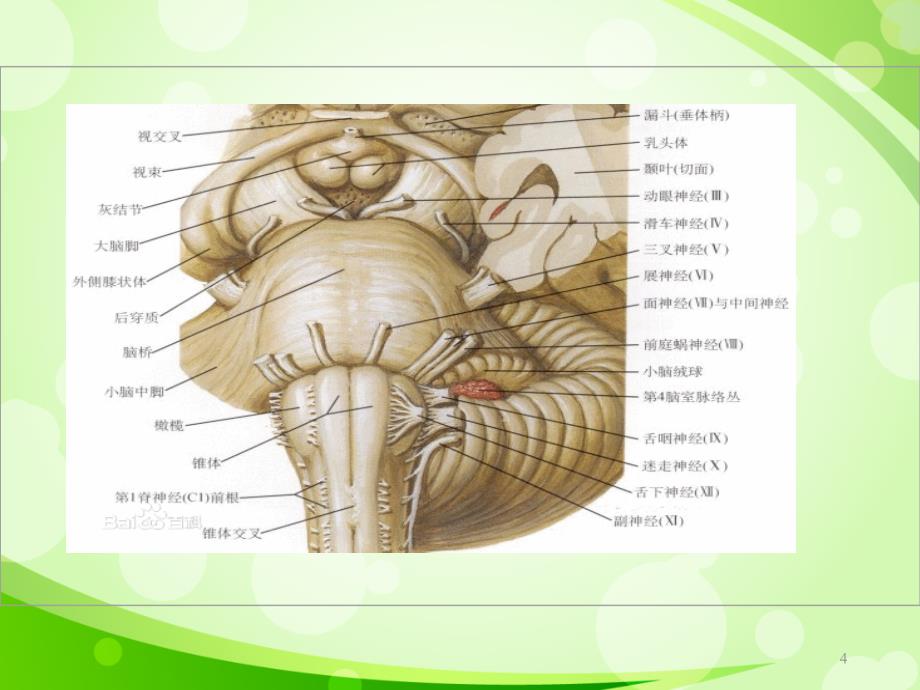 动眼神经麻痹常见病因PPT课件_第4页