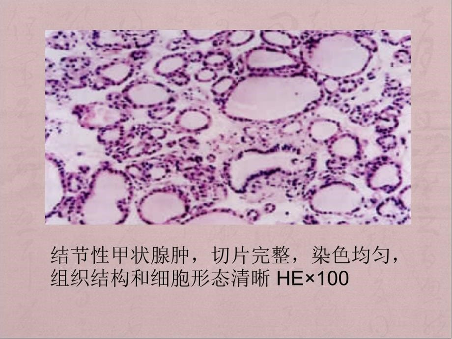 Leica自动染片机的使用心得.ppt_第5页