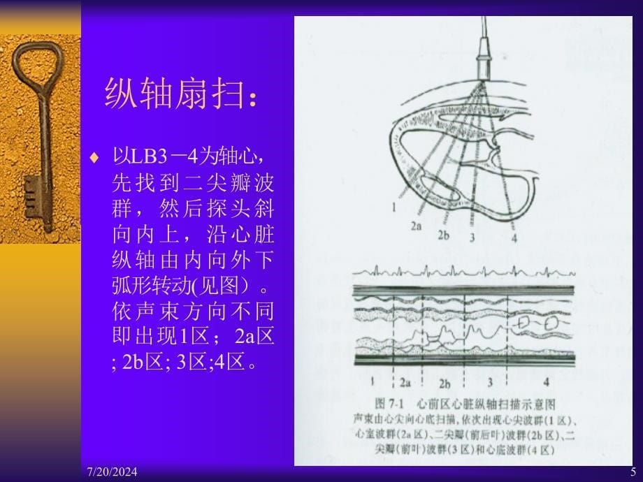 M型超声心动图2_第5页