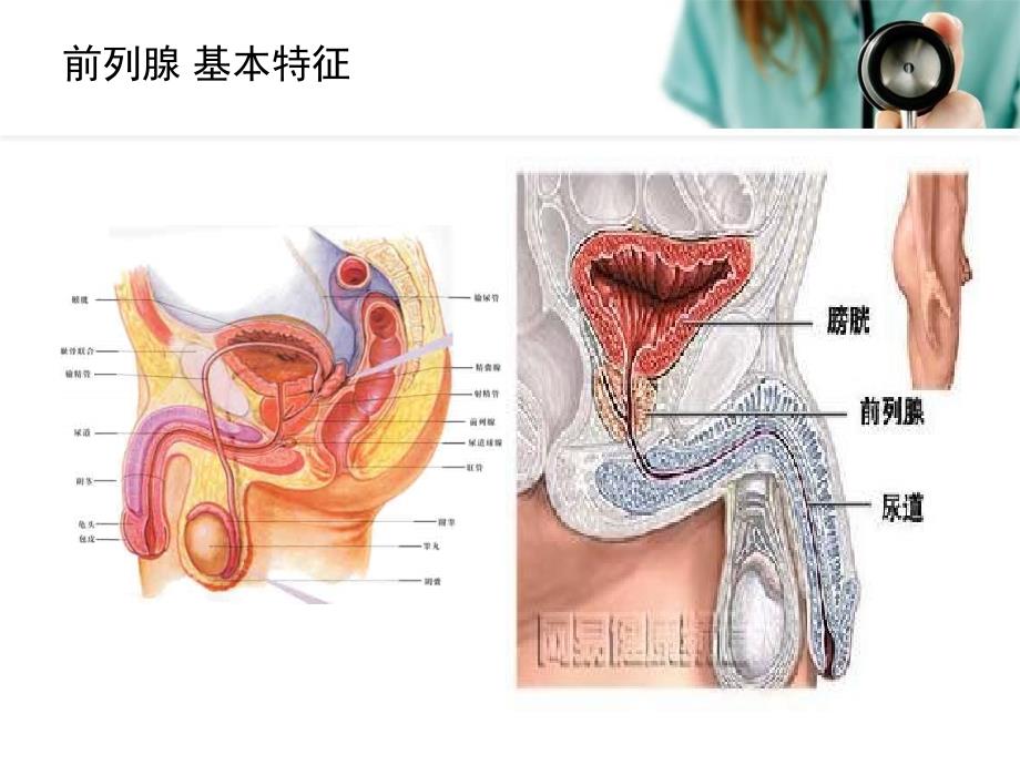 前列腺炎的护理课件_第4页