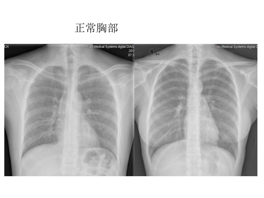 规培结能考试考前辅导：放射读片_第2页