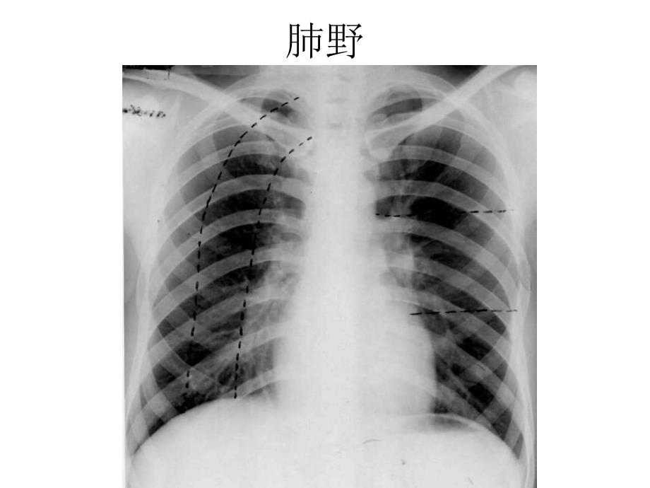 规培结能考试考前辅导：放射读片_第3页