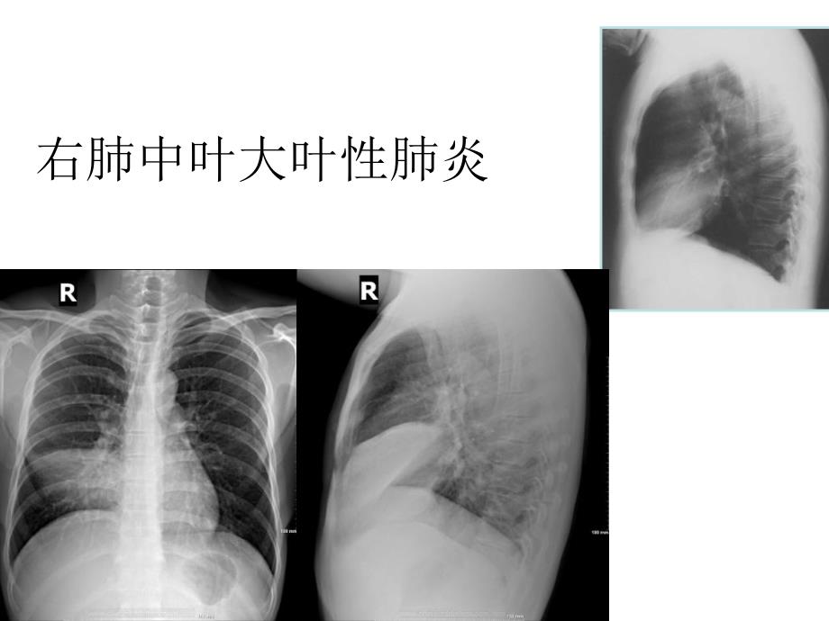 规培结能考试考前辅导：放射读片_第4页