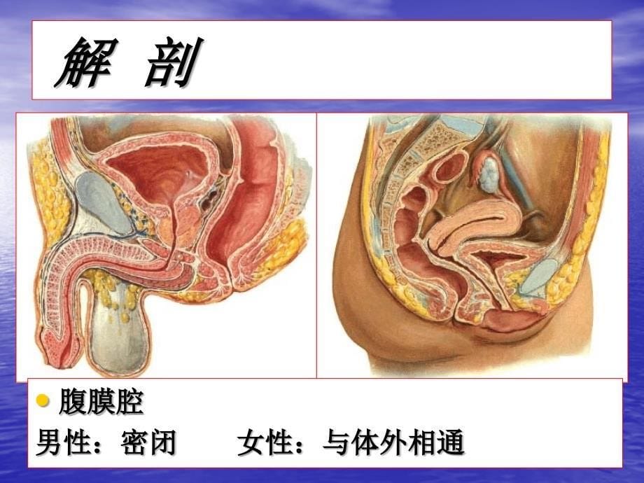 急性腹膜炎ppt课件_第5页