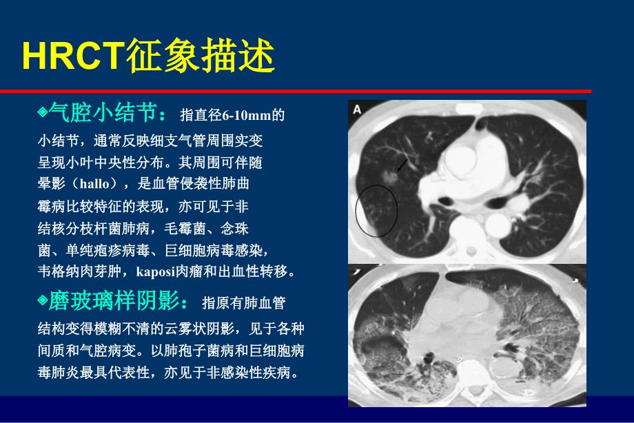 IPA类型及影像_第3页