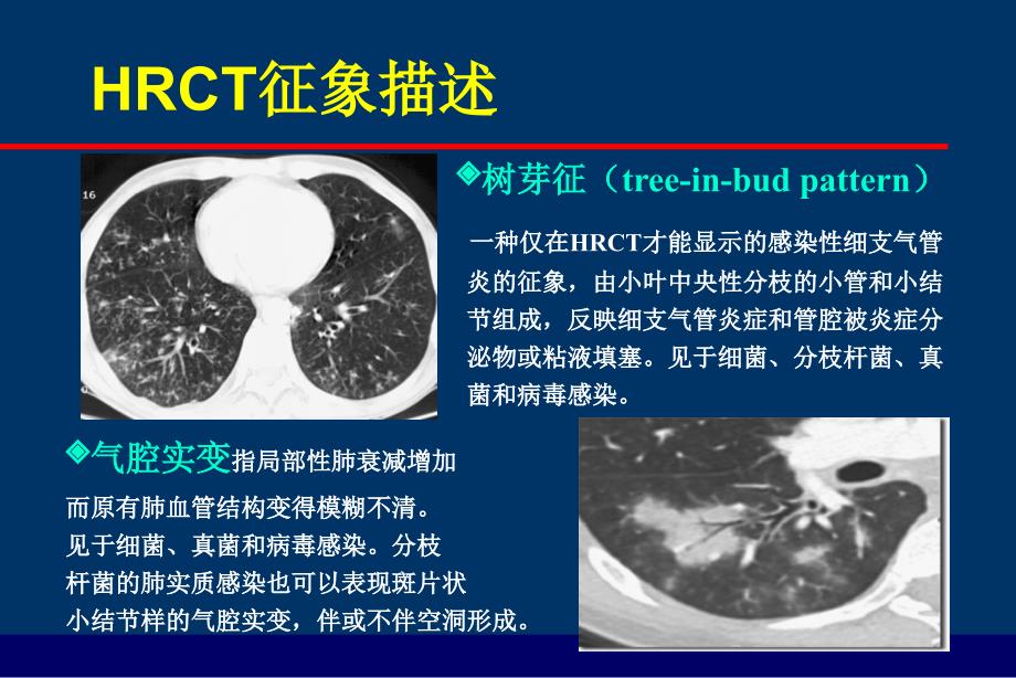 IPA类型及影像_第4页