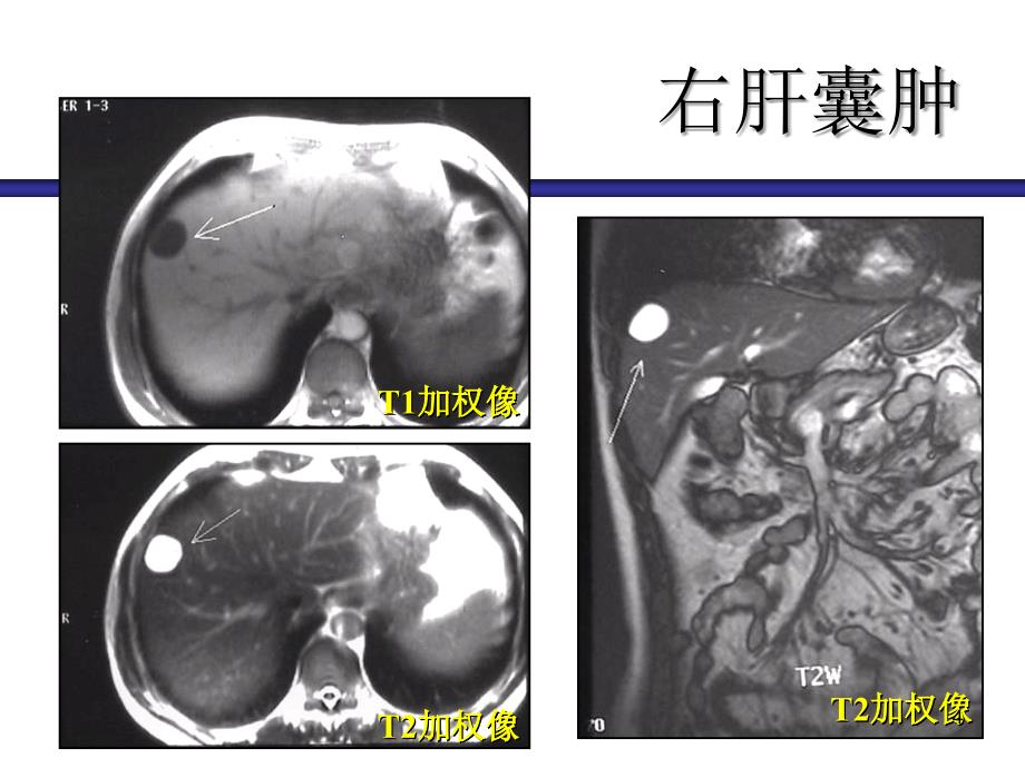 腹盆部影像图片ppt课件_第4页