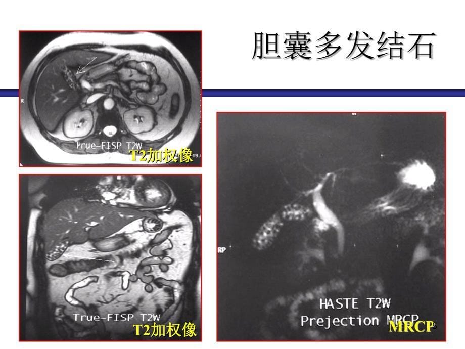 腹盆部影像图片ppt课件_第5页