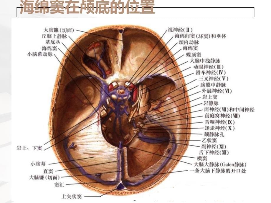 海绵窦综合征、眶上裂综合征及眶尖综合征_第5页