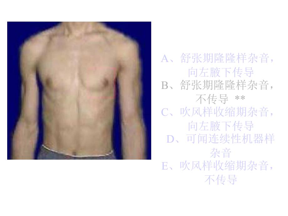 执业医师操作考试心脏听诊_第2页