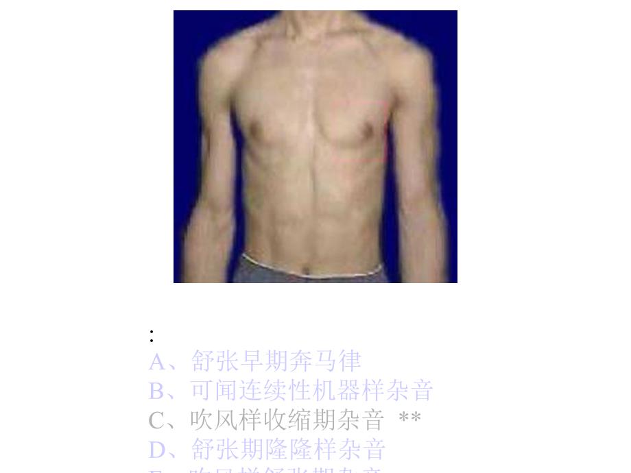 执业医师操作考试心脏听诊_第3页