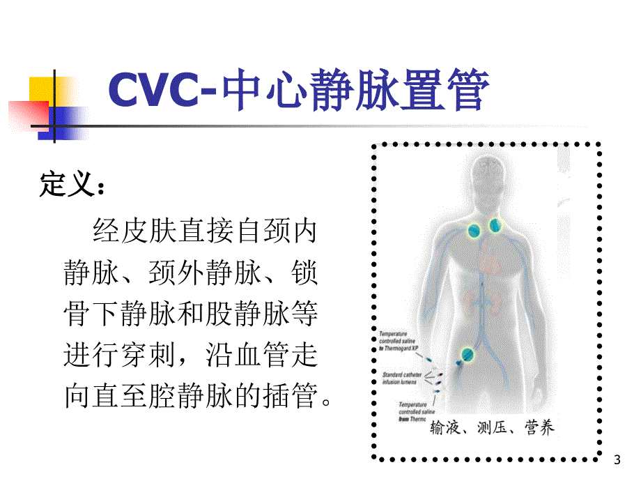 中心静脉置管的相关知识ppt课件_第3页