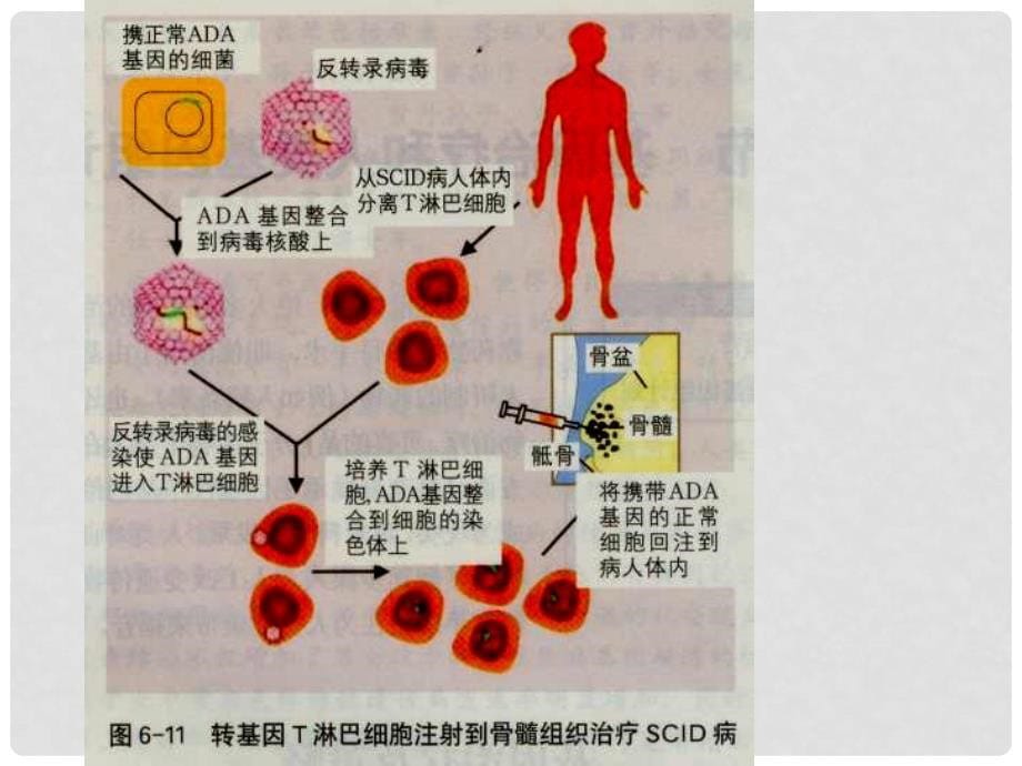 高中生物 63基因治疗和人类基因组计划课件 浙科版必修2_第5页