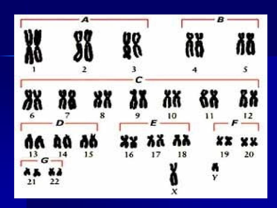 《染色体带型分析》PPT课件_第4页