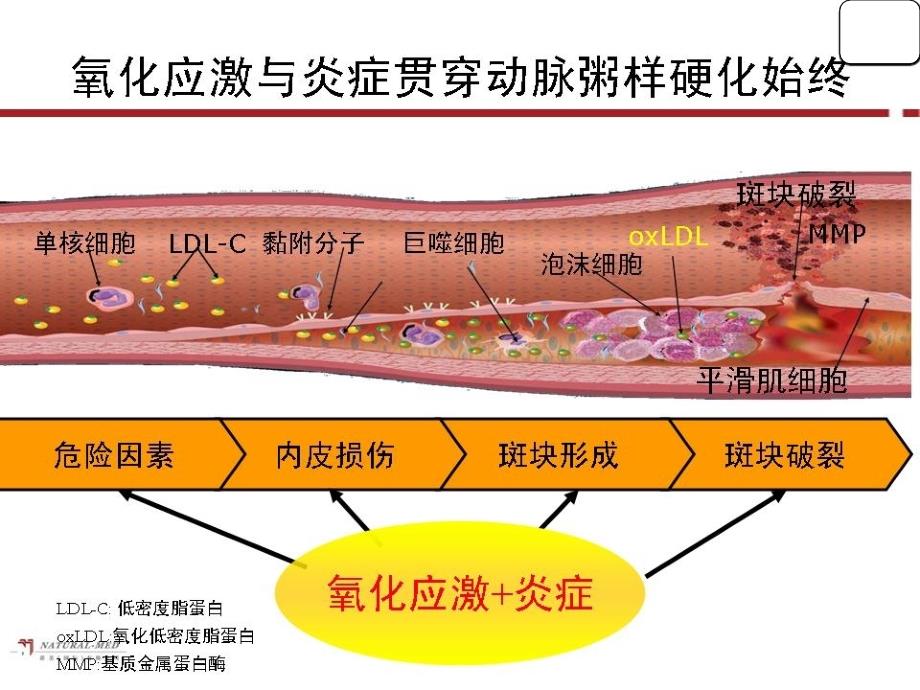 颅内动脉狭窄介入治疗新思考课件_第4页