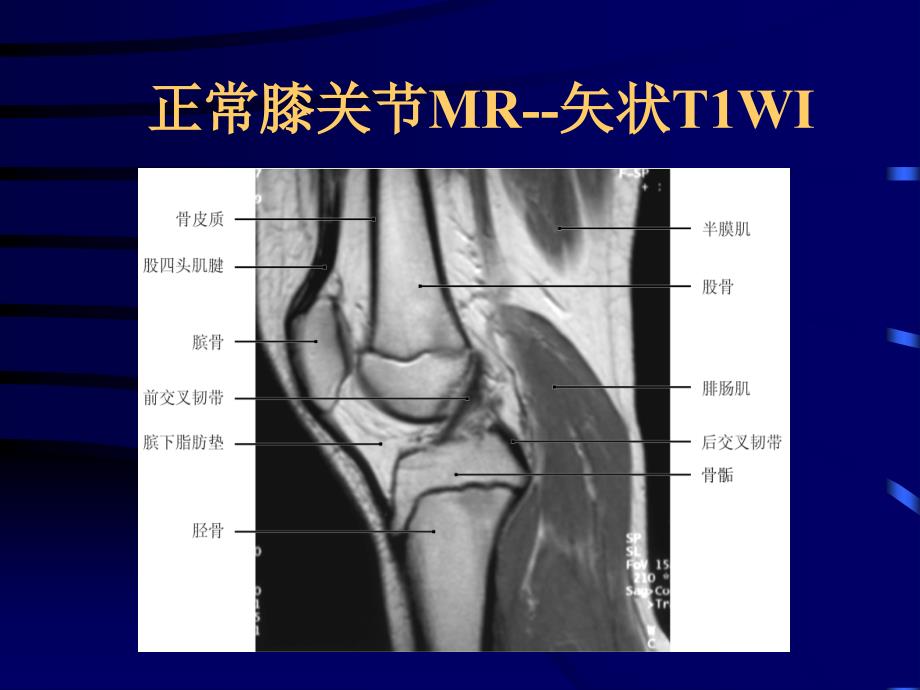 骨关节PPT课件_第4页