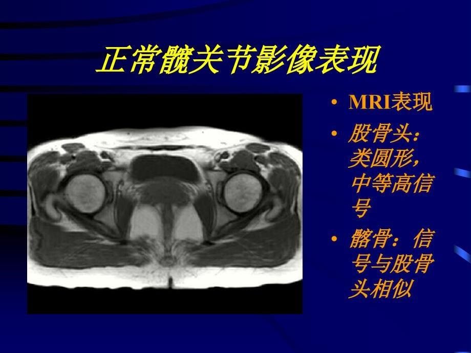 骨关节PPT课件_第5页