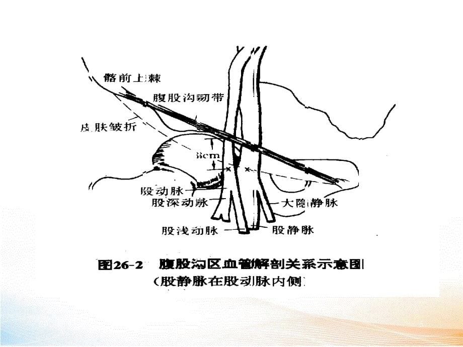 心脏电生理教学课件_第5页