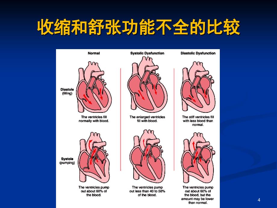 优质课件内科学心力衰竭_第4页