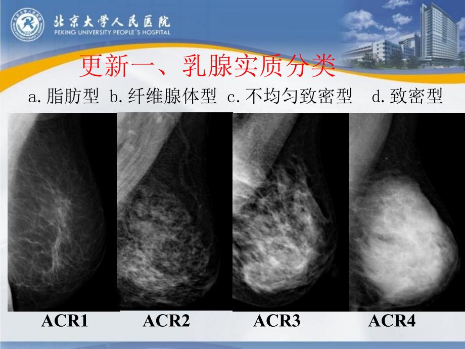 版第五版BIRADS分类更新解读乳腺钼靶ppt课件_第3页