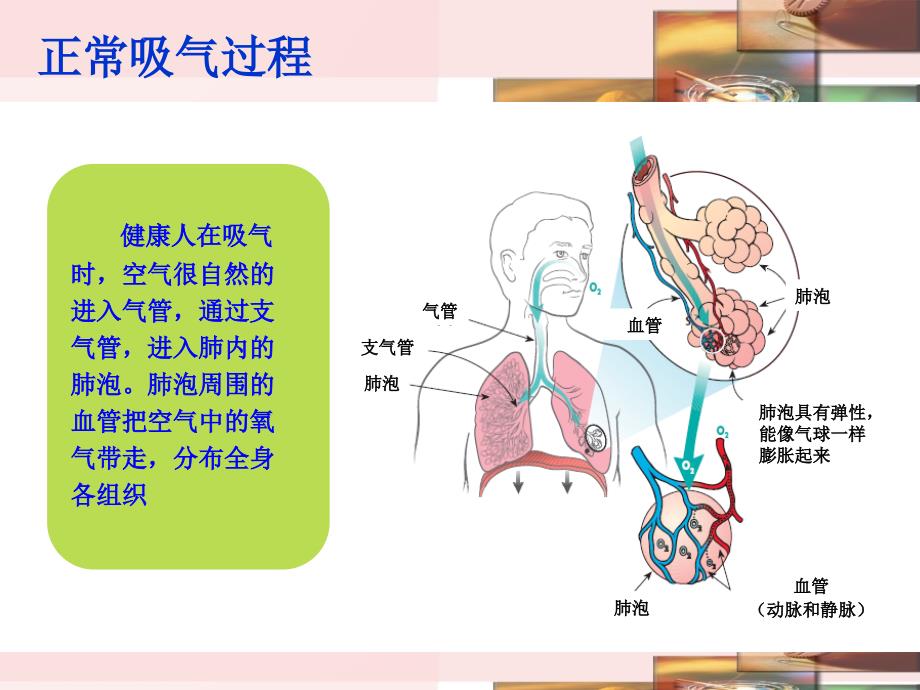 慢阻肺-呼吸衰竭_第4页