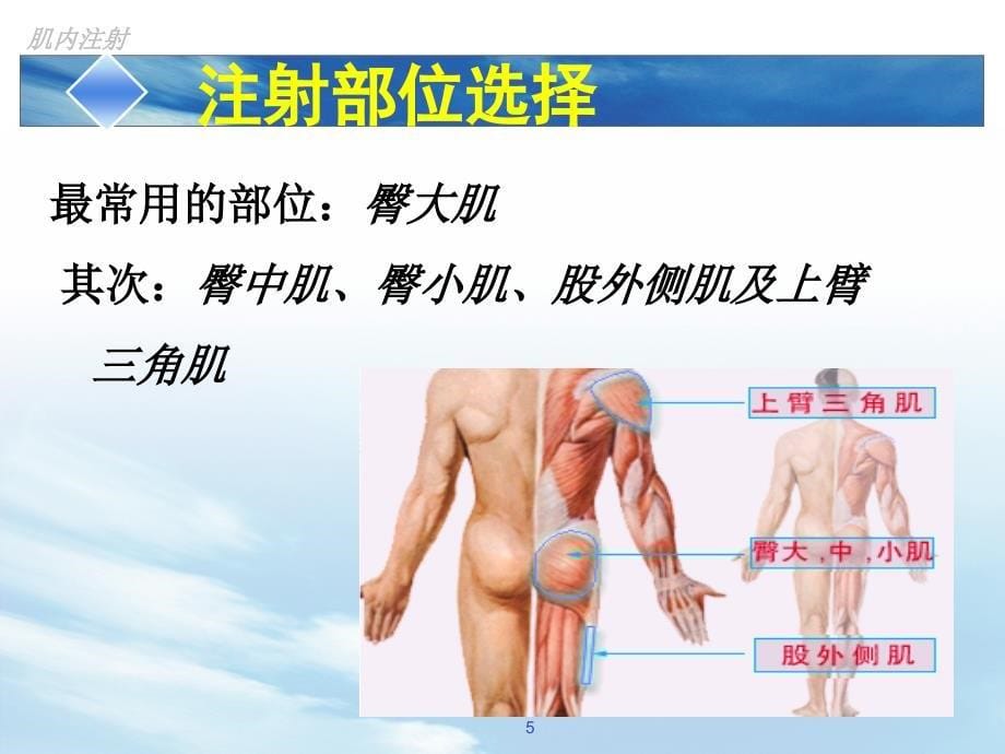 肌肉注射PPT课件.ppt_第5页