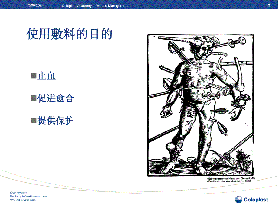 敷料的选择与应用.ppt_第3页