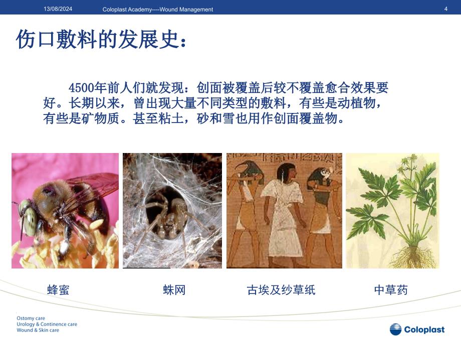 敷料的选择与应用.ppt_第4页