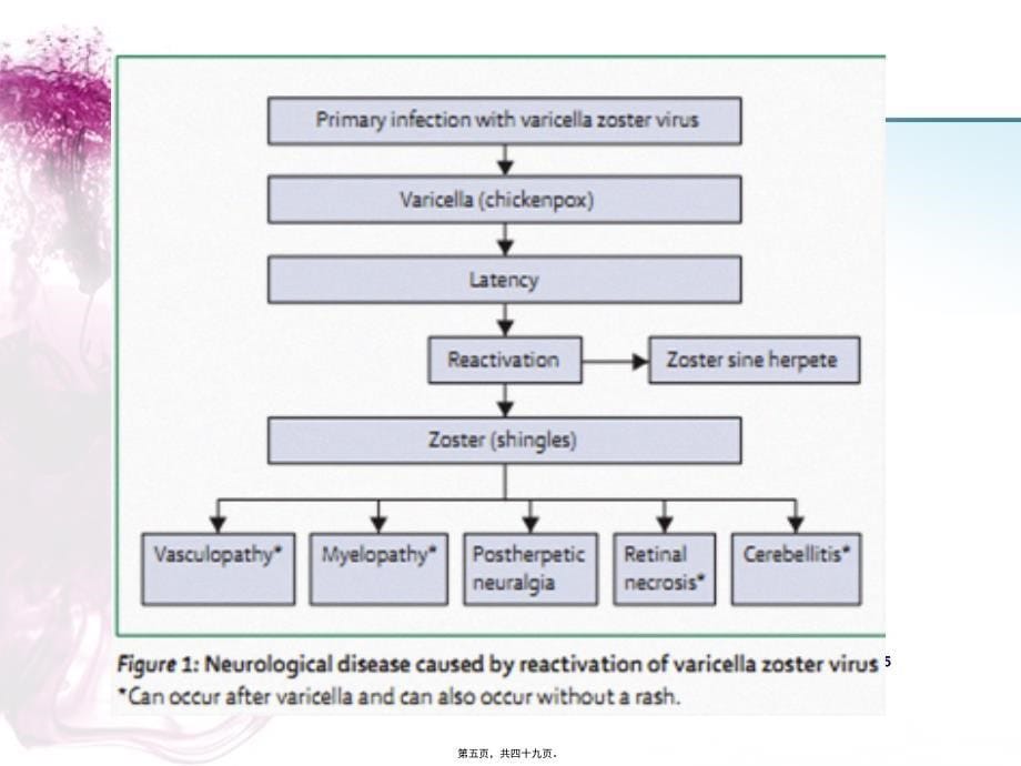 科内讲座-疱疹后疼痛课件_第5页