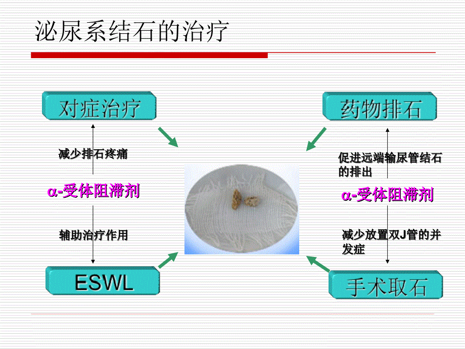 坦索罗辛治疗泌尿系结石新进展_第4页